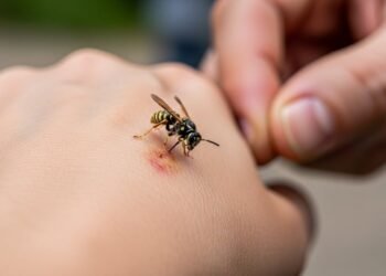 Especialistas explicam quando a picada de vespa se transforma em urgência médica e pode exigir internação imediata