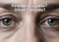 Olhar cansado e flacidez? Veja o que fazer para recuperar firmeza e viço na área dos olhos