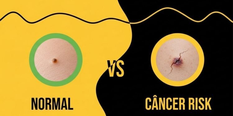 Cinco sinais silenciosos na pele podem esconder o câncer mais comum do país