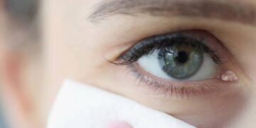 Como desinchar o rosto em casa com apenas uma colher e óleo de bebê