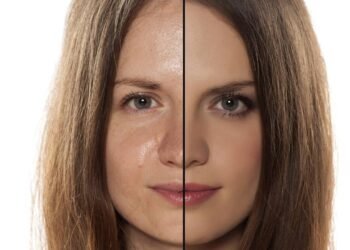 Sinais que revelam que sua pele está muito oleosa ou desidratada