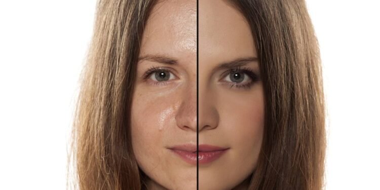 Sinais que revelam que sua pele está muito oleosa ou desidratada