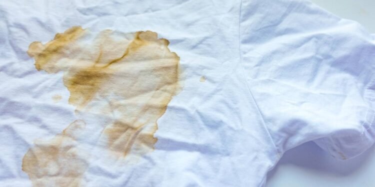 Como recuperar roupas brancas amareladas guardadas há anos