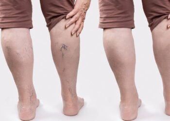 Esses exercícios simples fazem diferença nas pernas dos idosos