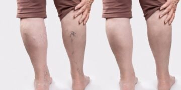 Esses exercícios simples fazem diferença nas pernas dos idosos