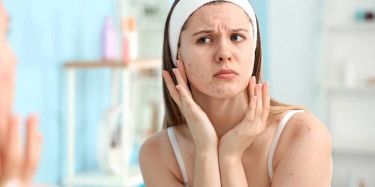 Você já percebeu como, nos dias bem quentes, a pele parece que fica “mais viva”, mais oleosa, brilhando e até incomodando - Créditos: depositphotos.com / serezniy