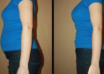 Como acordar mais leve e sem inchaço ajustando apenas alguns hábitos da sua rotina