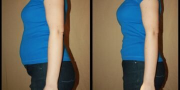 Como acordar mais leve e sem inchaço ajustando apenas alguns hábitos da sua rotina