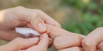 Esse método caseiro para tirar farpa está surpreendendo