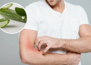 Planta resistente que alivia irritações e cresce onde você menos espera