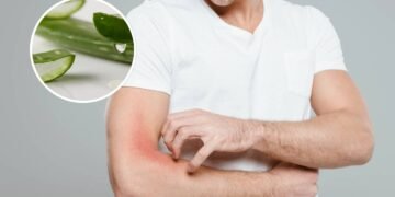 Planta resistente que alivia irritações e cresce onde você menos espera