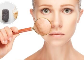 Minhas manchas pioravam a cada semana e o motivo tava pendurado no chuveiro