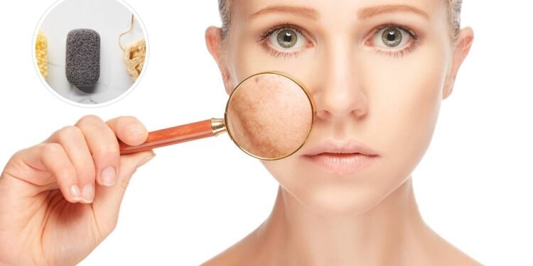 Minhas manchas pioravam a cada semana e o motivo tava pendurado no chuveiro