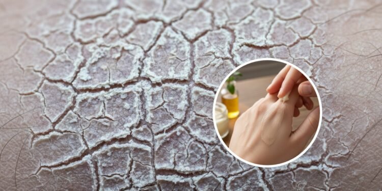Creme caseiro ajuda a aliviar a pele seca