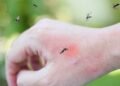 Confira essas soluções caseiras para espantar mosquitos e pernilongos