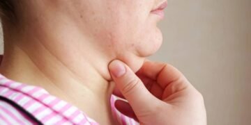 Acabe com a papada sem precisar de cirurgia fazendo esses exercícios faciais em casa