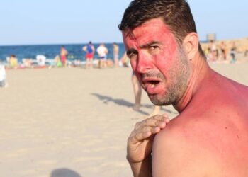 O cuidado pós-sol que acalma a pele e virou favorito de quem ama rotinas naturais