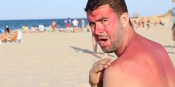 O cuidado pós-sol que acalma a pele e virou favorito de quem ama rotinas naturais