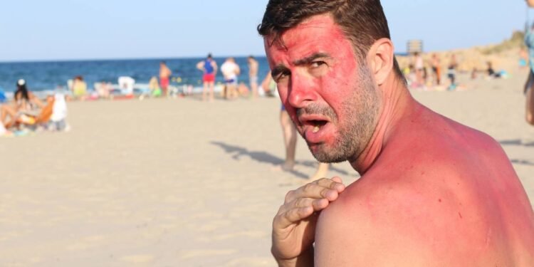 O óleo pós-sol com camomila e aloe vera tem sido uma alternativa buscada por pessoas que desejam aliviar a pele - Créditos: depositphotos.com / albejor2002@hotmail.com