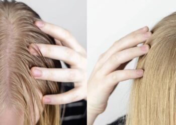 Chega de raiz pesada e pontas ressecadas, aprenda a como equilibrar seu cabelo