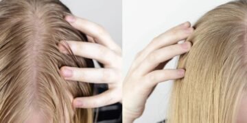 Chega de raiz pesada e pontas ressecadas, aprenda a como equilibrar seu cabelo