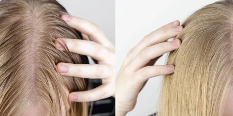 Quem tem a raiz do cabelo oleosa e as pontas secas costuma sofrer para achar um jeito de cuidar bem dos fios no dia a di - Créditos: depositphotos.com / Alena1919