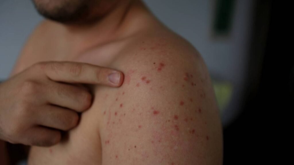 arampo cresce e vira preocupação entre médicos e famílias