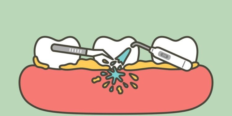 Receita caseira para tratar e prevenir os tártaros em casa