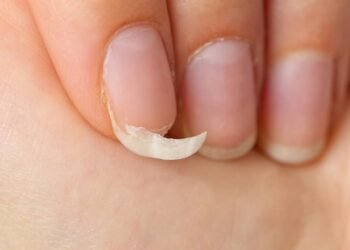 Pare de sofrer com unhas quebradas e aprenda a consertar sem precisar ir no salão