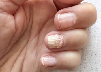 Hábitos diários que parecem inofensivos mas destroem a queratina das unhas