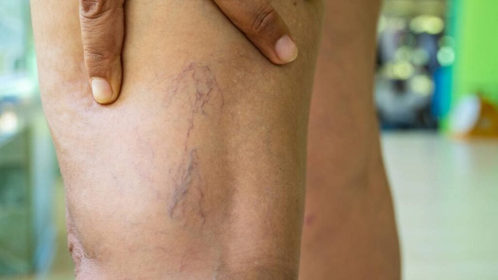 Esses exercícios simples fazem diferença nas pernas dos idosos