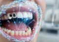 Nova tecnologia com inteligência artificial promete detectar câncer bucal antes dos primeiros sintomas e pode salvar milhares de vidas