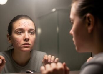 Maquiagem boa não basta: se você tem acne, precisa fazer isso na limpeza ou vai continuar com o rosto irritado