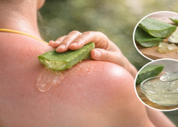 Aloe vera vira aliada natural no alívio de queimaduras de sol