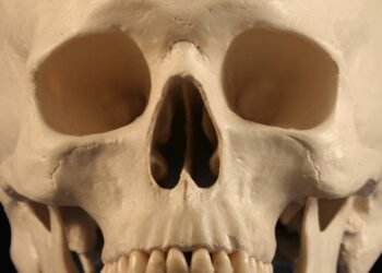 Por que médicos guardam parte do crânio no abdômen