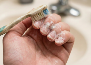 Escove as unhas com essa mistura e ajude a combater fungos naturalmente