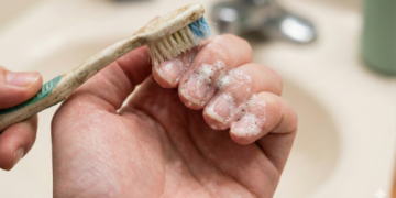 Escove as unhas com essa mistura e ajude a combater fungos naturalmente