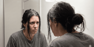 Raiz oleosa mas as pontas secas? Saiba como reduzir desconforto e controlar oleosidade