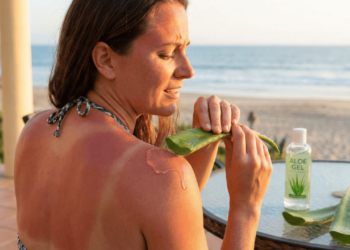 O que realmente acontece na pele quando você aplica babosa depois da sofrer uma queimadura solar