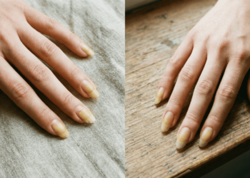 Como clarear as unhas amareladas em casa com segurança e rapidez