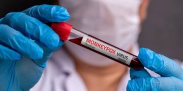 O alerta científico sobre mpox que preocupa pesquisadores