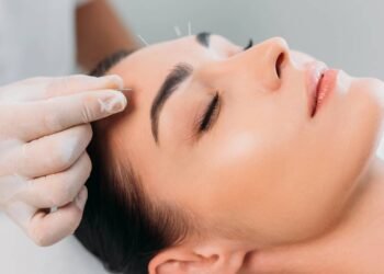 Acabe com as olheiras, bolsas e pálpebras caídas com os benefícios da acupuntura para os olhos