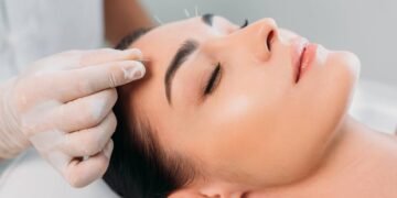 Acabe com as olheiras, bolsas e pálpebras caídas com os benefícios da acupuntura para os olhos