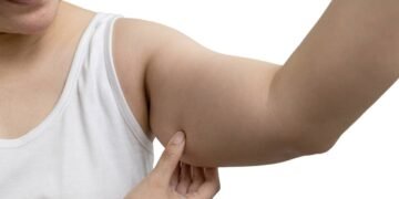 Tchauzinho sem balançar: 5 exercícios para firmar o braço em casa