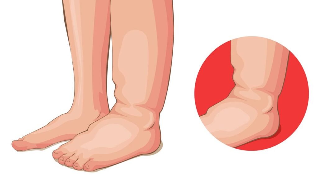 A melhor forma de reduzir o inchaço nas suas pernas e tornozelos