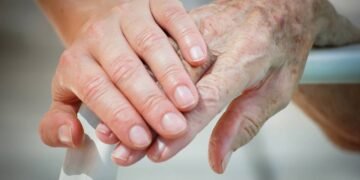 A melhor coisa para mãos secas com rugas e manchas