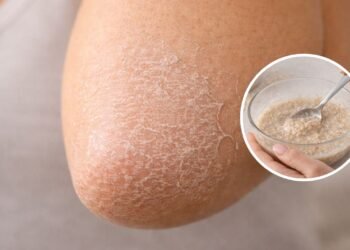 Cotovelos secos pedem cuidado e poucos fazem isso