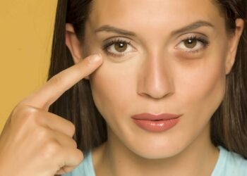 Por que jovens ainda tem bolsas abaixo dos olhos?