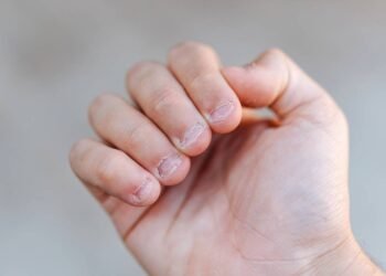 Morder as unhas pode indicar ansiedade e merece atenção