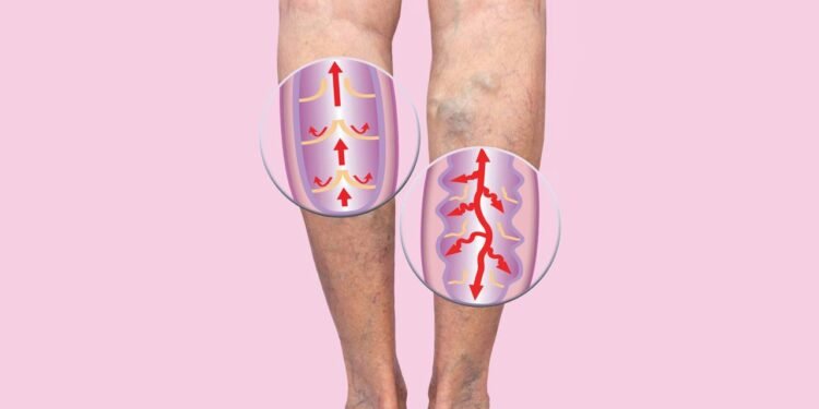 Cinco bebidas mágicas para desentupir veias e artérias